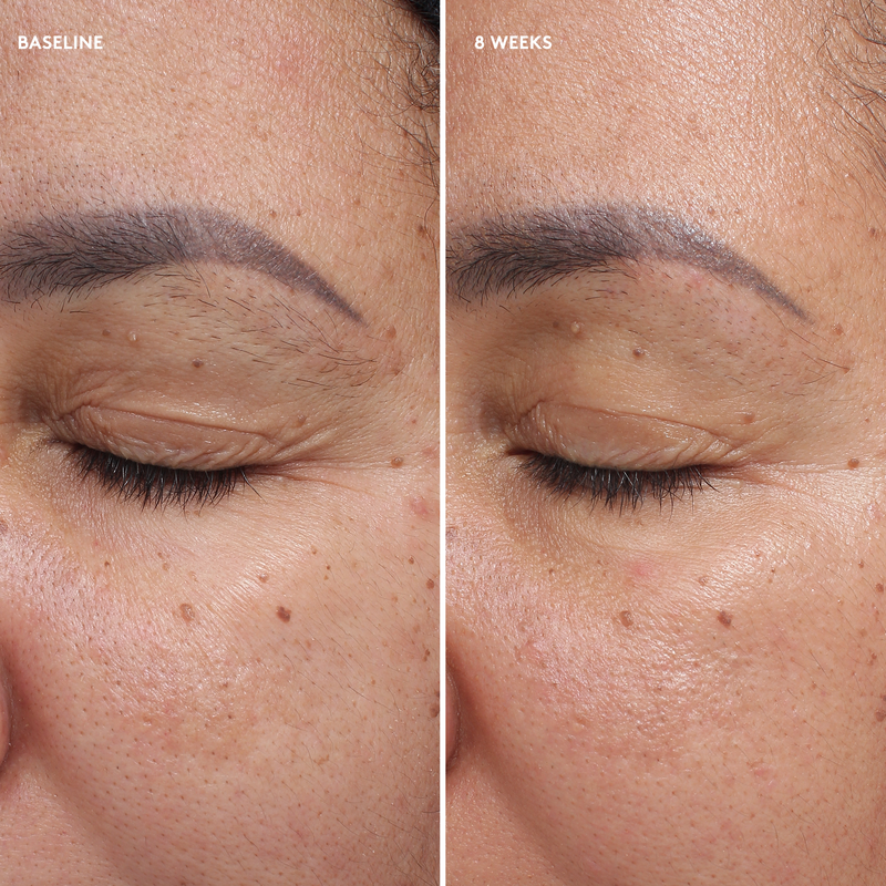 before and after of woman&
